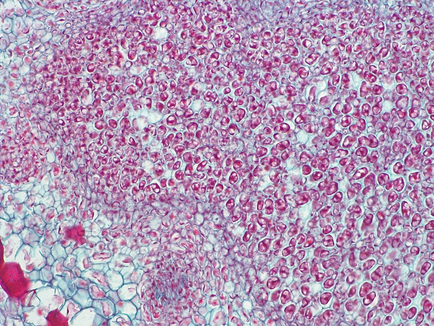 Root Nodule Slides - Root Nodule 02 200X